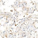 IL-15 Antibody in Immunohistochemistry (Paraffin) (IHC (P))