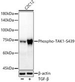 Phospho-TAK1 (Ser439) Antibody in Western Blot (WB)