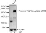 Phospho-VEGF Receptor 2 (Tyr1175) Antibody in Western Blot (WB)