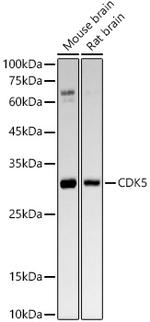 CDK5 Antibody in Western Blot (WB)