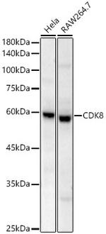 CDK8 Antibody in Western Blot (WB)