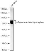 Dopamine beta Hydroxylase Antibody in Western Blot (WB)