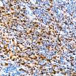 IRF4 Antibody in Immunohistochemistry (Paraffin) (IHC (P))