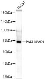 Peptidylarginine Deiminase Antibody in Western Blot (WB)