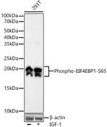 Phospho-4EBP1 (Ser65) Antibody in Western Blot (WB)