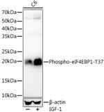 Phospho-4EBP1 (Thr37) Antibody in Western Blot (WB)