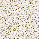 Phospho-MDM2 (Ser166) Antibody in Immunohistochemistry (Paraffin) (IHC (P))