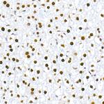 Phospho-MDM2 (Ser166) Antibody in Immunohistochemistry (Paraffin) (IHC (P))