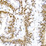 Phospho-MDM2 (Ser166) Antibody in Immunohistochemistry (Paraffin) (IHC (P))