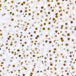 Phospho-MDM2 (Ser166) Antibody in Immunohistochemistry (Paraffin) (IHC (P))