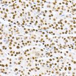 Phospho-MDM2 (Ser166) Antibody in Immunohistochemistry (Paraffin) (IHC (P))