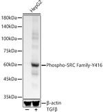 Phospho-SRC (Tyr416) Antibody in Western Blot (WB)