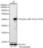 Phospho-SRC (Tyr416) Antibody in Western Blot (WB)