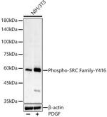 Phospho-SRC (Tyr416) Antibody in Western Blot (WB)