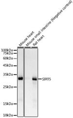 SIRT5 Antibody in Western Blot (WB)