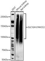 NKCC2 Antibody in Western Blot (WB)