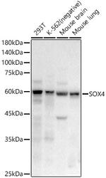 SOX4 Antibody in Western Blot (WB)