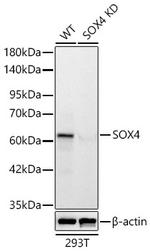 SOX4 Antibody in Western Blot (WB)