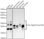 VHL Antibody in Western Blot (WB)