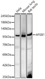 beta-2 Adaptin Antibody in Western Blot (WB)