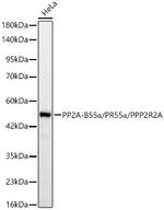 PPP2R2A Antibody in Western Blot (WB)