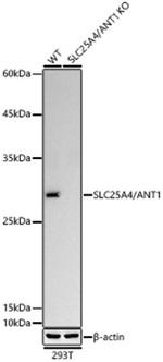 ANT Antibody in Western Blot (WB)