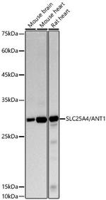 ANT Antibody in Western Blot (WB)