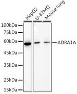 alpha-1a Adrenergic Receptor Antibody in Western Blot (WB)