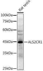 ALS2CR1 Antibody in Western Blot (WB)