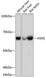 Asparagine Synthetase Antibody in Western Blot (WB)