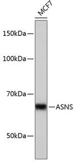 Asparagine Synthetase Antibody in Western Blot (WB)