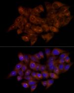 FGFR1OP Antibody in Immunocytochemistry (ICC/IF)