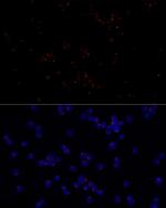 FGFR1OP Antibody in Immunocytochemistry (ICC/IF)