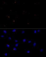 FGFR1OP Antibody in Immunocytochemistry (ICC/IF)