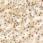 CHD4 Antibody in Immunohistochemistry (Paraffin) (IHC (P))