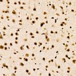 CHD4 Antibody in Immunohistochemistry (Paraffin) (IHC (P))