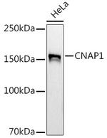 NCAPD2 Antibody in Western Blot (WB)