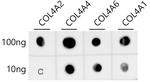 Collagen IV Antibody in Peptide array (ARRAY)