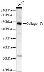 Collagen IV Antibody in Western Blot (WB)