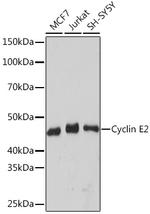 Cyclin E2 Antibody in Western Blot (WB)