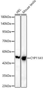 CYP11A1 Antibody in Western Blot (WB)