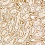 DGAT1 Antibody in Immunohistochemistry (Paraffin) (IHC (P))