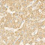 DGAT1 Antibody in Immunohistochemistry (Paraffin) (IHC (P))