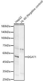 DGAT1 Antibody in Western Blot (WB)