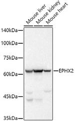 EPHX2 Antibody in Western Blot (WB)