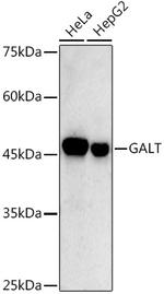 GALT Antibody in Western Blot (WB)