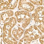 METTL4 Antibody in Immunohistochemistry (Paraffin) (IHC (P))