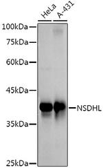 NSDHL Antibody in Western Blot (WB)