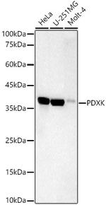 PDXK Antibody in Western Blot (WB)