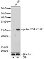 Phospho-RAC1/CDC42 (Ser71) Antibody in Western Blot (WB)